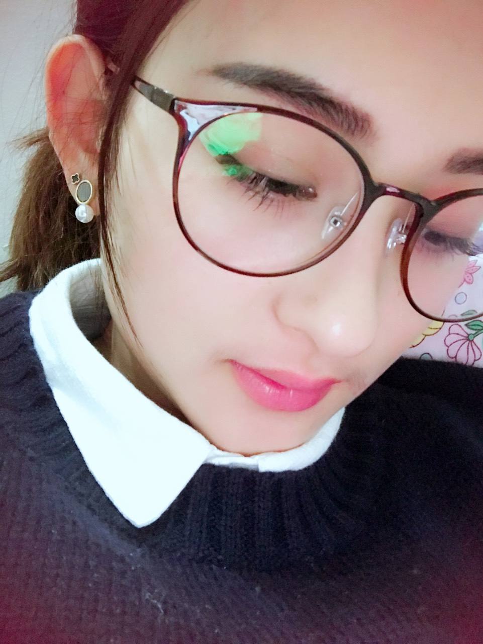 肿泡眼适合做什么类型的双眼皮手术呢?168 肿泡眼适合做什么类型的双眼皮手术呢?168
