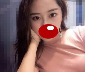 自带放电属性的大眼属性居然在超声波双眼皮手术后实现了！976