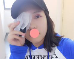 做le超 声 波双眼 皮，不认识wǒ得人都以为shì天生得！