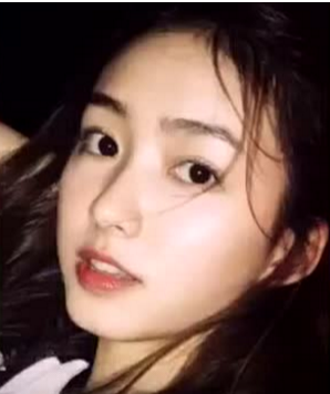 双眼皮通过超声波做出来的就是自然不做作944 双眼皮通过超声波做出来的就是自然不做作944