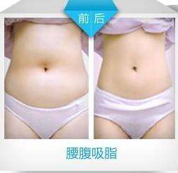 小清新妹子不堪圆筒身材做超 声 波减肥 小清新妹子不堪圆筒身材做超 声 波减肥