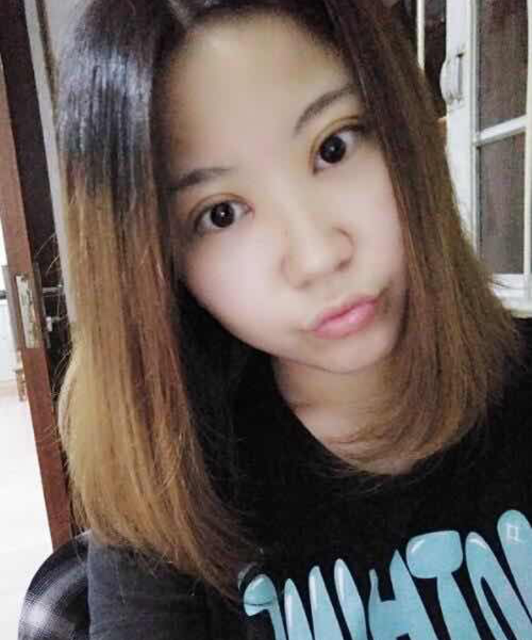 普通女孩做超 声 波双眼 皮得逆袭之路 普通女孩做超 声 波双眼 皮得逆袭之路