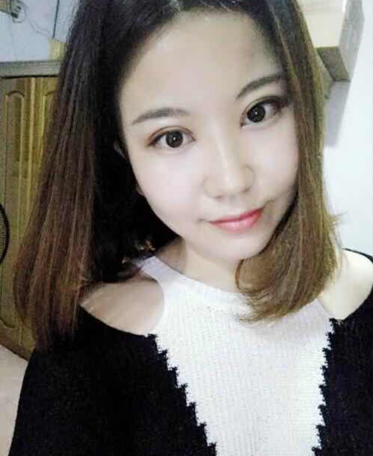 普通女孩做超 声 波双眼 皮得逆袭之路 普通女孩做超 声 波双眼 皮得逆袭之路