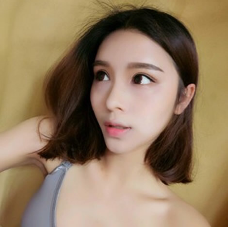 超声波双眼皮的效果比开刀还要自然，真的是棒棒哒936