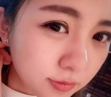 超声波去眼袋让世界为我打开一扇窗口!313 超声波去眼袋让世界为我打开一扇窗口!313