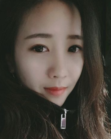 超声波去眼袋后化身成为小仙女!735 超声波去眼袋后化身成为小仙女!735