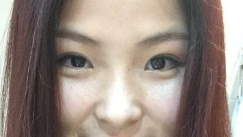 超雅医学美容院超 声 波双眼 皮帮你塑造完美眼形！