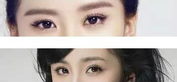 超声波双眼皮让你美丽无暇!628 超声波双眼皮让你美丽无暇!628