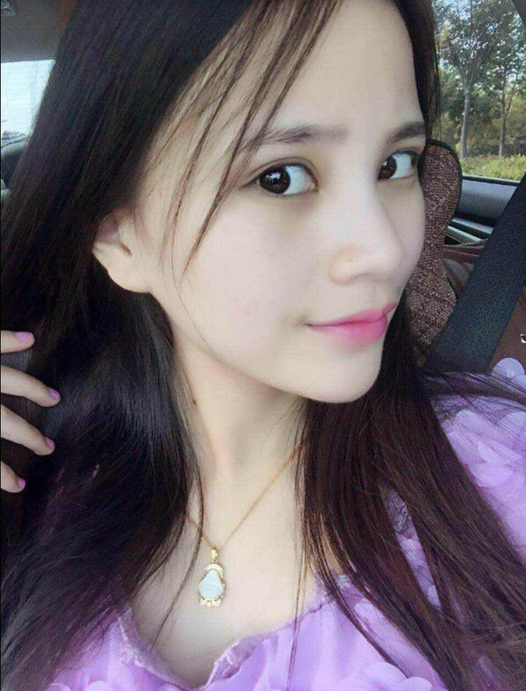 wǒ做le超 声 波双眼 皮，效果不错，分享给你们吧