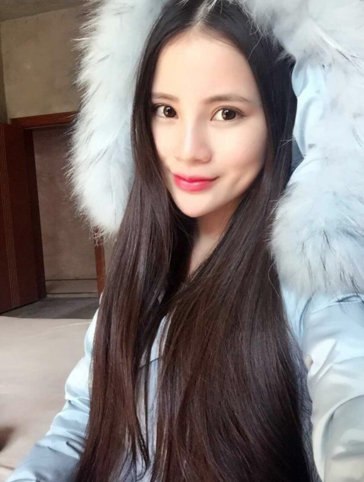 wǒ做le超 声 波双眼 皮，效果不错，分享给你们吧