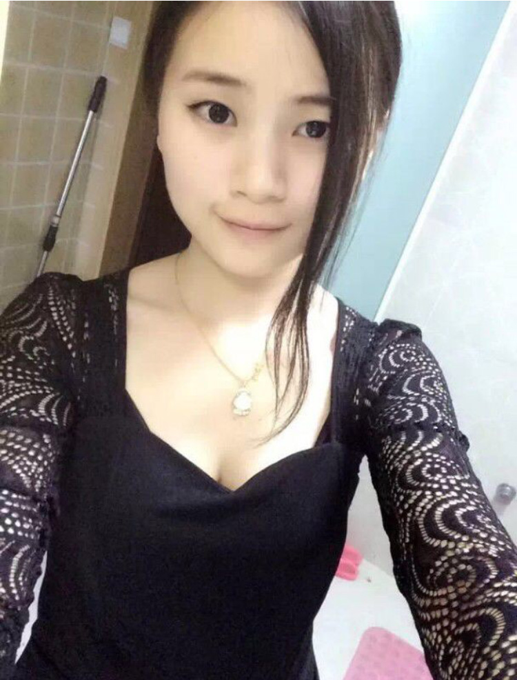 wǒ做le超 声 波双眼 皮，效果不错，分享给你们吧