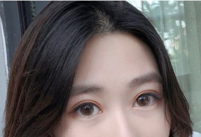 超声波双眼皮你选择他的五大理由715 超声波双眼皮你选择他的五大理由715