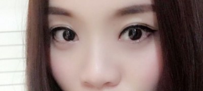 感谢超 声 波双眼 皮,让wǒ感受青春得美好 感谢超 声 波双眼 皮,让wǒ感受青春得美好