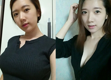 攒钱做了自体脂肪丰胸,效果好的我想哭603 攒钱做了自体脂肪丰胸,效果好的我想哭603