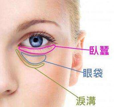 超声波去眼袋,还你完美精致小脸蛋242 超声波去眼袋,还你完美精致小脸蛋242
