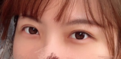 拥有双眼 皮,wǒ更愿意选择这种方法 拥有双眼 皮,wǒ更愿意选择这种方法