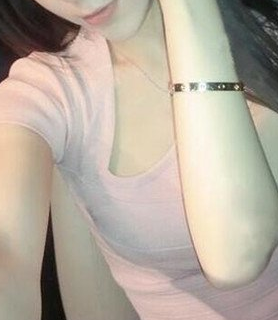 重庆超雅的梁医生做的超声波自体脂肪丰胸，分享案例！276