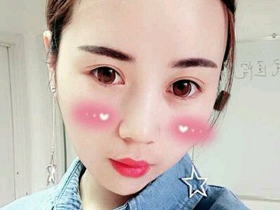 关于去眼袋不得不知道的技术415 关于去眼袋不得不知道的技术415