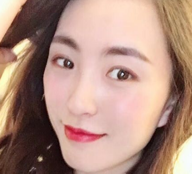 眼袋大怎么解决——超声波去眼袋217 眼袋大怎么解决——超声波去眼袋217
