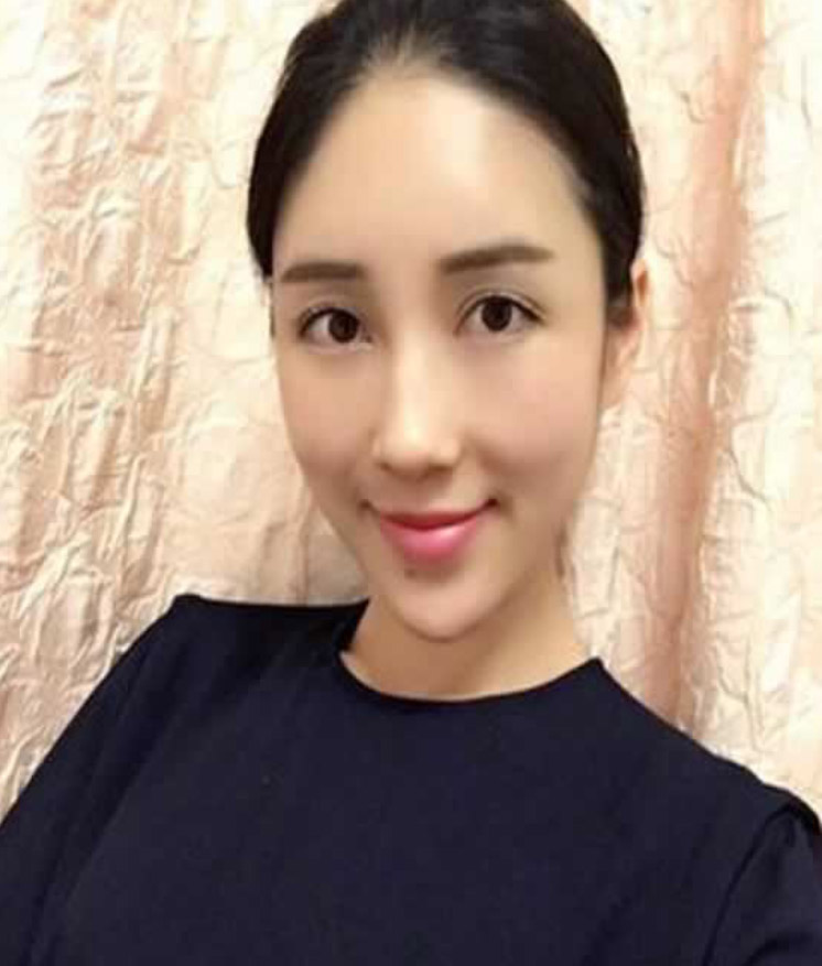 祛除脂肪型眼袋还是得选超声波去眼袋822 祛除脂肪型眼袋还是得选超声波去眼袋822
