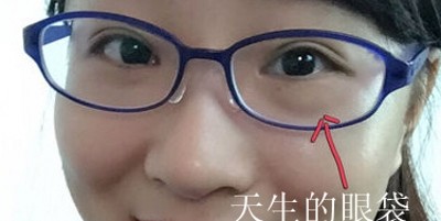 超声波去眼袋,对着镜子看美丽的自己244 超声波去眼袋,对着镜子看美丽的自己244