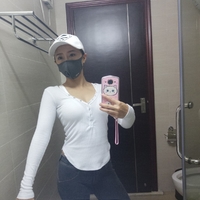 超声波自体脂肪丰胸后倍儿有面017 超声波自体脂肪丰胸后倍儿有面017