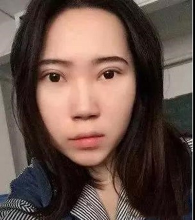 超声波去眼袋,让你重返青春美少女940 超声波去眼袋,让你重返青春美少女940