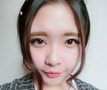 四年做了两次眼袋消除术，还是超声波去眼袋好用！832