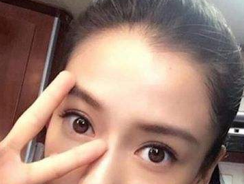 四年做了两次眼袋消除术，还是超声波去眼袋好用！832