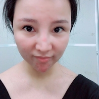 彭氏童颜术唤醒肌肤年轻化768 彭氏童颜术唤醒肌肤年轻化768