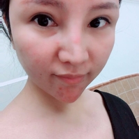 彭氏童颜术唤醒肌肤年轻化768 彭氏童颜术唤醒肌肤年轻化768