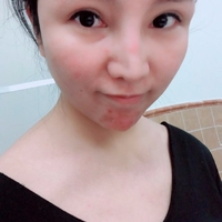 彭氏童颜术唤醒肌肤年轻化768 彭氏童颜术唤醒肌肤年轻化768