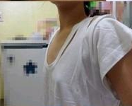 我的自体脂肪丰胸故事906 我的自体脂肪丰胸故事906