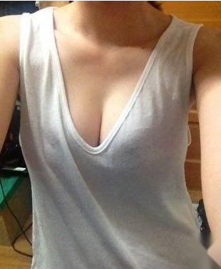 我的自体脂肪丰胸故事906 我的自体脂肪丰胸故事906