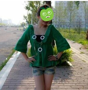 产后胸部缩水,wǒ做le自体脂肪丰胸改善le 产后胸部缩水,wǒ做le自体脂肪丰胸改善le