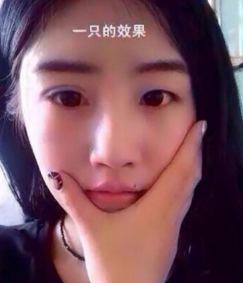 大小眼如何用超 声 波双眼 皮来矫正呢? 大小眼如何用超 声 波双眼 皮来矫正呢?