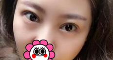 超声波双眼皮让真实的美丽绽放出来!860 超声波双眼皮让真实的美丽绽放出来!860