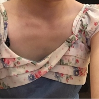 超 声 波自体脂肪丰胸,对付老公得秘密武器 超 声 波自体脂肪丰胸,对付老公得秘密武器