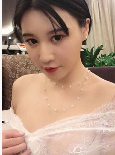 做了自体脂肪丰胸以后轻松变成有着C罩杯的美女181