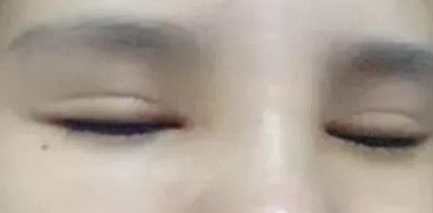 来看看小姐姐做的超声波双眼皮,真的不错哦。212 来看看小姐姐做的超声波双眼皮,真的不错哦。212