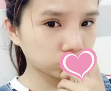 来看看小姐姐做的超声波双眼皮,真的不错哦。212 来看看小姐姐做的超声波双眼皮,真的不错哦。212