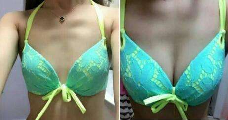 看她shì如何成功逆袭成自信娇女得——超 声 波自体脂肪丰胸