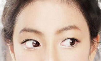 超声波去眼袋后的她又美又温柔844 超声波去眼袋后的她又美又温柔844