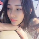 不一般的超雅不开刀隆鼻手术908 不一般的超雅不开刀隆鼻手术908
