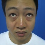 老婆陪wǒ来超雅做超 声 波去眼袋 老婆陪wǒ来超雅做超 声 波去眼袋