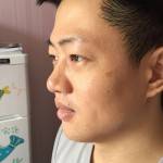 老婆陪wǒ来超雅做超 声 波去眼袋 老婆陪wǒ来超雅做超 声 波去眼袋