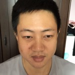 老婆陪wǒ来超雅做超 声 波去眼袋 老婆陪wǒ来超雅做超 声 波去眼袋