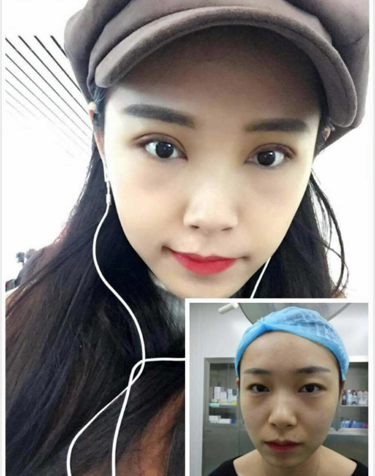 做双眼 皮wǒ只选超雅 做双眼 皮wǒ只选超雅