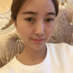 我的超声波去眼袋的记录~352 我的超声波去眼袋的记录~352
