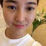 我的超声波去眼袋的记录~352 我的超声波去眼袋的记录~352